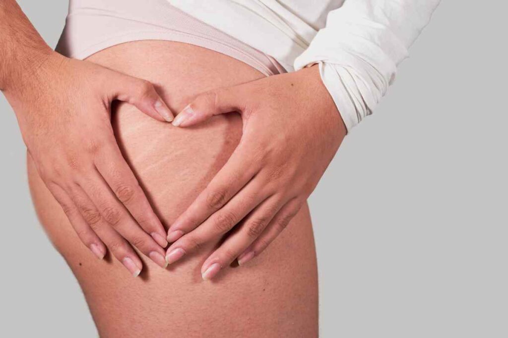Ritenzione idrica estiva, i consigli degli esperti: ecco tutti i dettagli