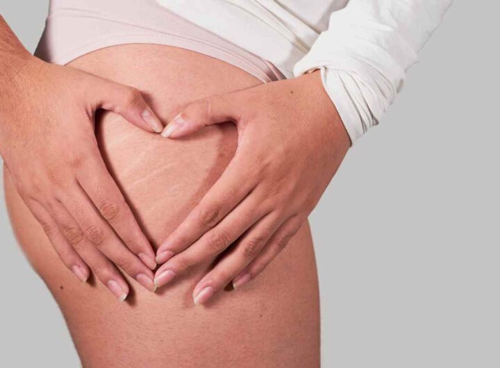 Ritenzione idrica estiva, i consigli degli esperti: ecco tutti i dettagli